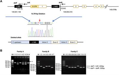 Oculocutaneous albinism and bleeding diathesis due to a novel deletion in the HPS3 gene